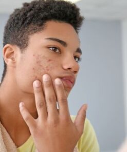 khoa-hoc-cham-soc-da-cho-da-mun