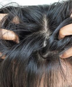 khoa-hoc-xu-ly-nam-toc-tai-nha-phong-ngua-tai-phat