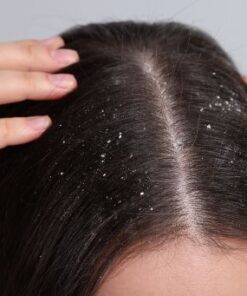 thong-tin-khoa-hoc-xu-ly-nam-toc-tai-nha